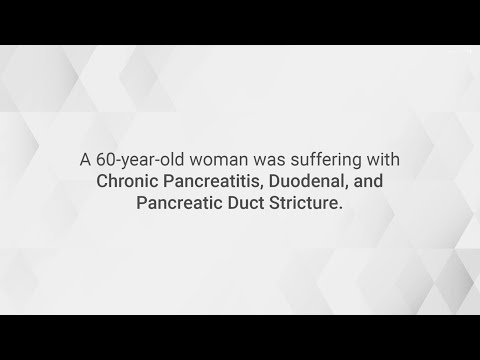 Successful EUS Guided Gastrojejunostomy for Chronic Pancreatitis First Time in Faridabad