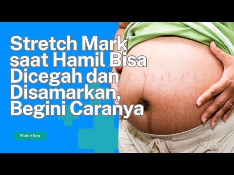 7 Tips Jitu Mengurangi Strecth Mark Pada Saat Hamil #tips #mengurangi #strecthmark #hamil #ibuhamil