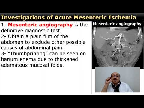 Acute Mesenteric Ischemia