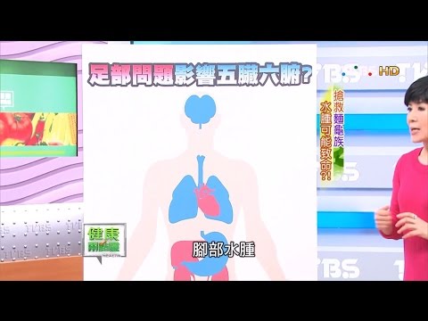 小心！下肢水腫可能是重大疾病的徵兆？健康兩點靈完整版)