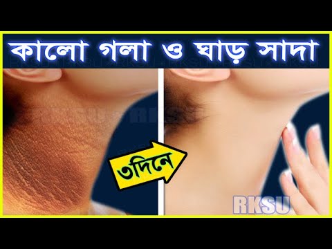 ঘাড় ও গলা থেকে কালো দাগ দূর করার উপায়।ধবধবে সাদা ও ফর্সা গলা পাবেন সহজেই Skin Lightening