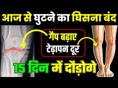 घिसे हुए घुटने का गैप बढ़ाएं पैर मजबूत करें|Knee Pain Exercises|Knee Joint Pain Relief Exercises