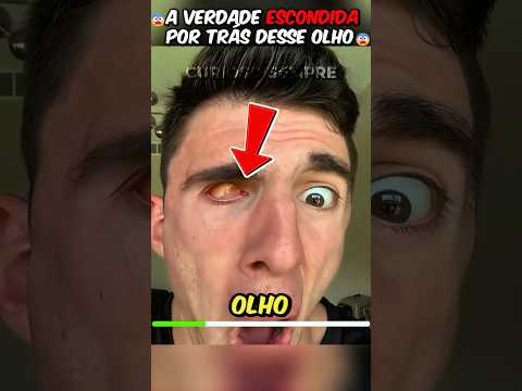 O QUE SAIU DO OLHO DELE VAI TE CHOCAR! #curiosidade #curiosidades #interesante