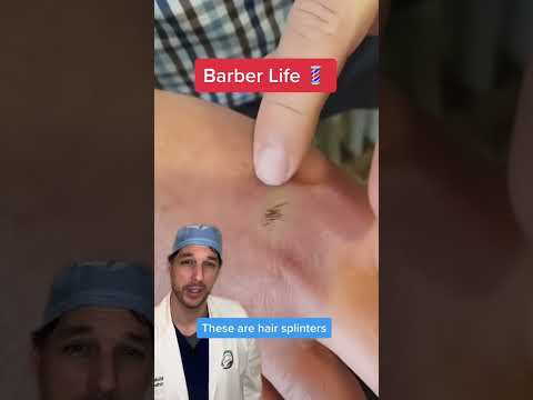 Talk about taking your work home with you! #Barber #Hair #HairSplinter#Painful#Educational #Dr#Nurse