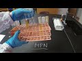Coliforms and MPN Testing Methods