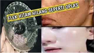 Nyesel Baru Coba Sekarang!! Menghilang Semua Jenis Flek Hitam yang Ada Tanpa Bekas