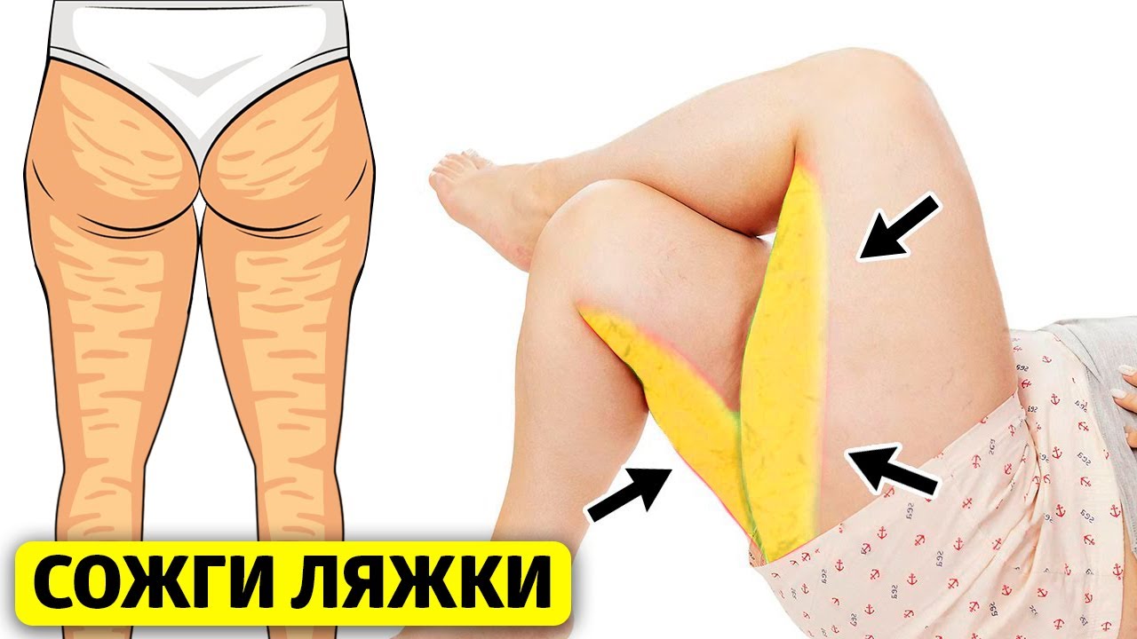 Как убрать жир с задней поверхности бедра - сожги ляжки