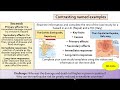 Earthquake Impacts and Tectonic Plates