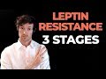 Leptin Resistance and Weight Management