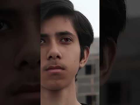 Ben VS Albedo | Ben 10 Transformation in Real Life #Ben10 #Omnitrix #Ben10Classic