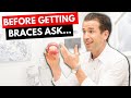 Top 10 Things to Know Before Getting Braces