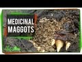 Maggot Therapy and Its Historical and Modern Applications