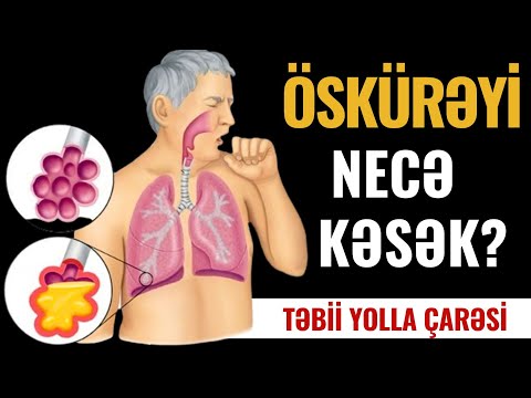 ÖSKÜRƏK - Təbii Yolla 1 Həfətəyə Tamam Kəsin!