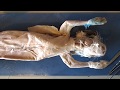 Muscle Functions and Anatomy