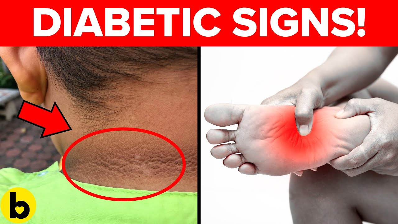 8 Signs that you didn’t know could mean you are Diabetic