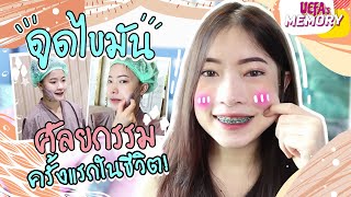 Vlog พาดูดไขมันเหนียง | Uefa's Memory