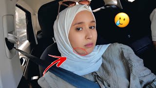 فجأة طلعت لي على وجهي 🥲 مشكلة !!