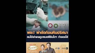 ผงะ! ผ่าตัดก้อนหินปริศนา คนไข้เล่าเคยถูกหมอผีอินโดฯ ทำของใส่