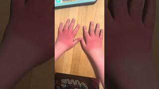 Cyrus Skiing - Working On His Skier Tan #cyskiing