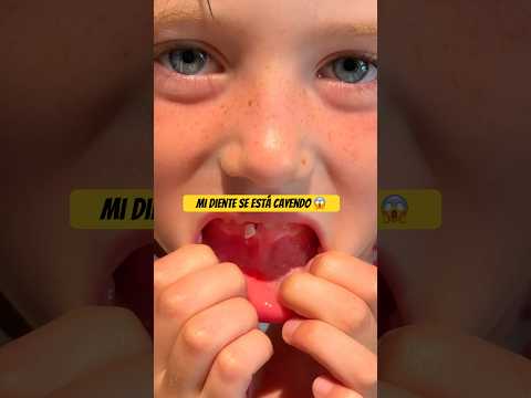 A nuestra hija roma se le cae su diente y viene el ratón Pérez 😱 #shorts