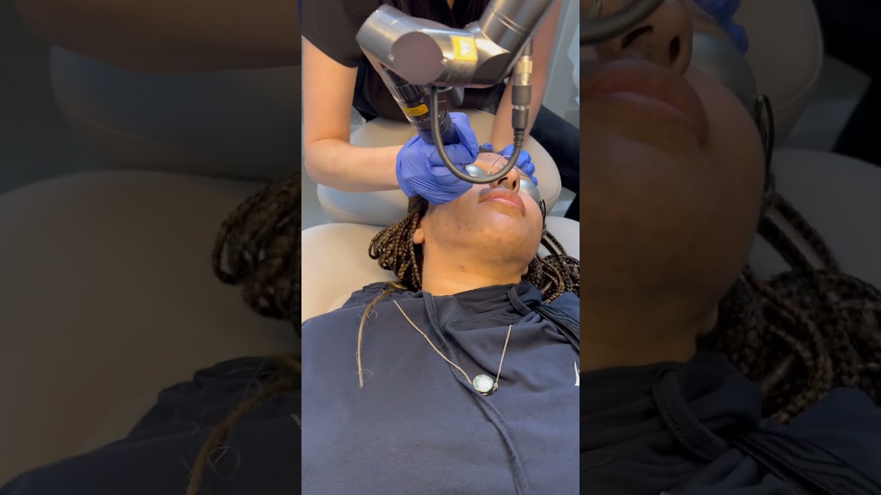Laser facial treatment in progress at clinic.