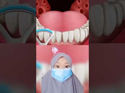 Asmr infeksi gigitan Ular menjadi belatung |Mv #shorts