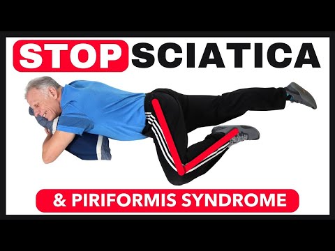 Stop Piriformis & Sciatica Pain with These Stretches