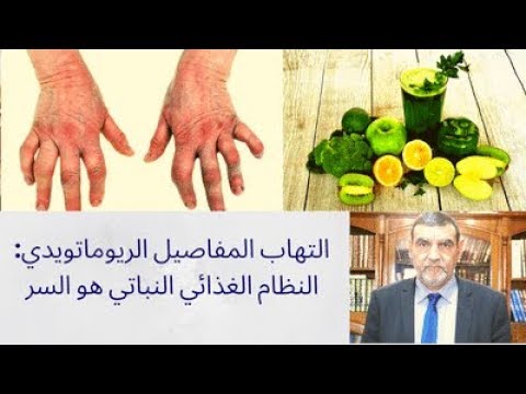 الدكتور محمد فائد || التهاب المفاصيل الريوماتويدي : النظام الغذائي النباتي هو السر
