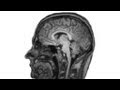 Understanding Dyscalculia