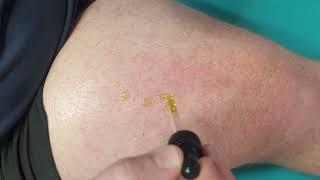 TCM Cupping & Gua Sha Massage – Traditionelle Heilkunst für Entspannung & Gesundheit | ASMR Sounds