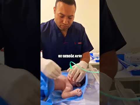 Kahraman doktor ikiz Bebekleri hayata döndürdü 👼🏻