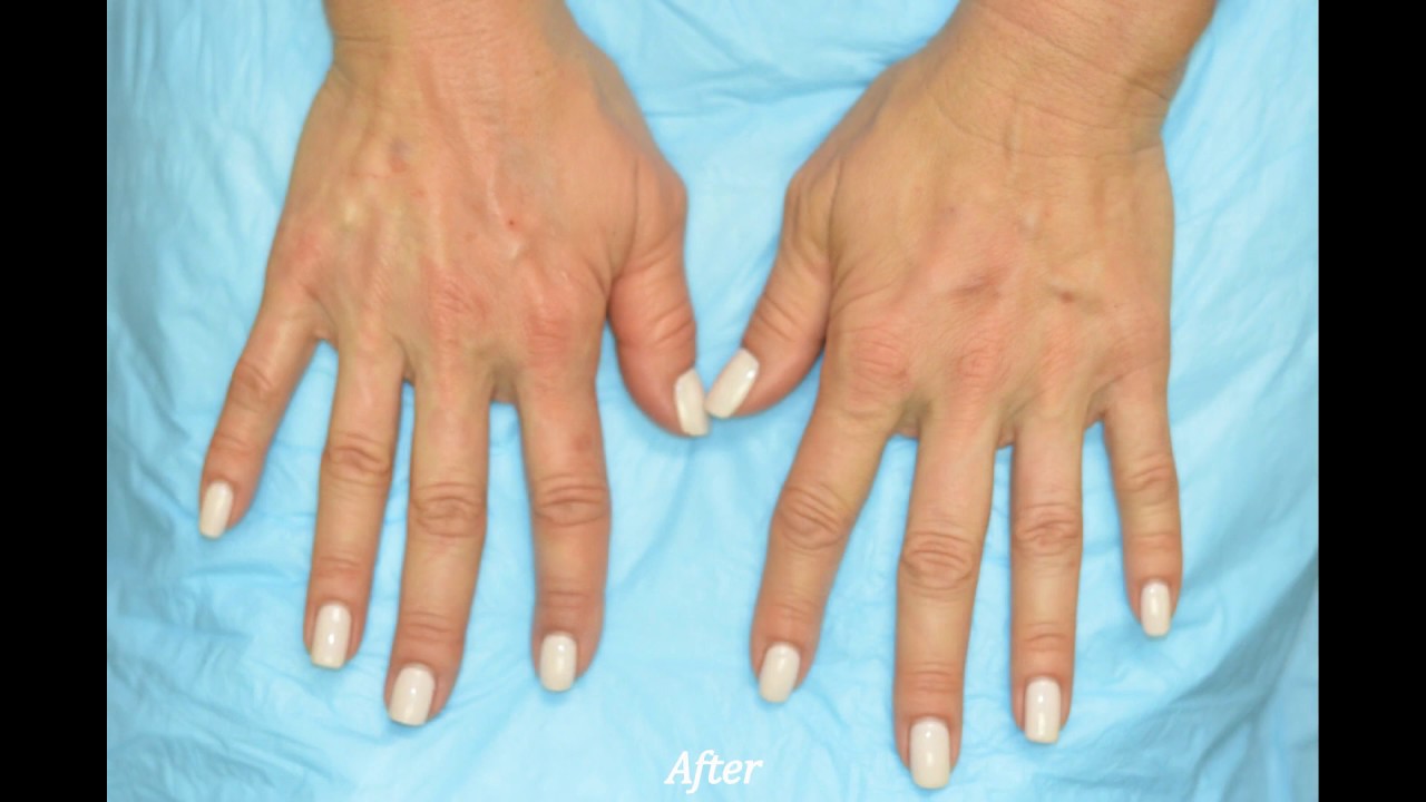 Well-manicured hands with neutral nail polish.