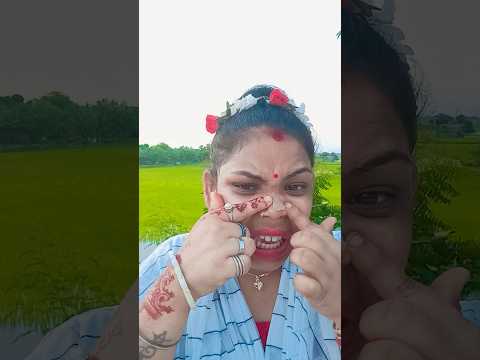 How I Cured a Bug Bite with Yogurt in the Wild | Survival Hacks🤩🥰🤷#funny #shorts