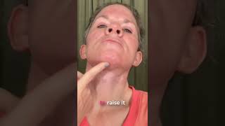 My Daily Scar Cream Routine & Results!