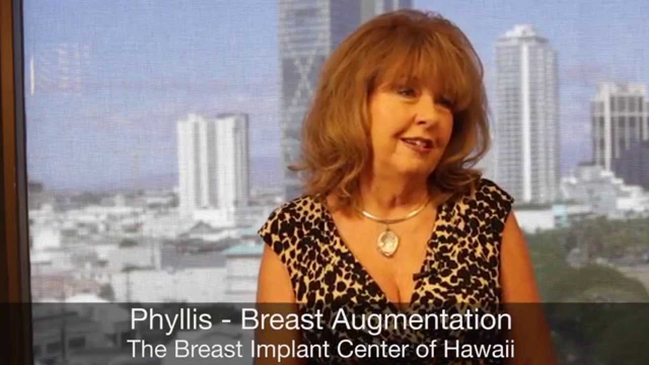 Why Phyllis Had Breast Augmentation - Dr. S. Larry Schlesinger - Breast Implant Center of Hawaii