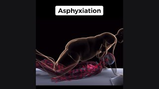 Dumbest Ways People Have Died 💀 (Shorts Compilation)