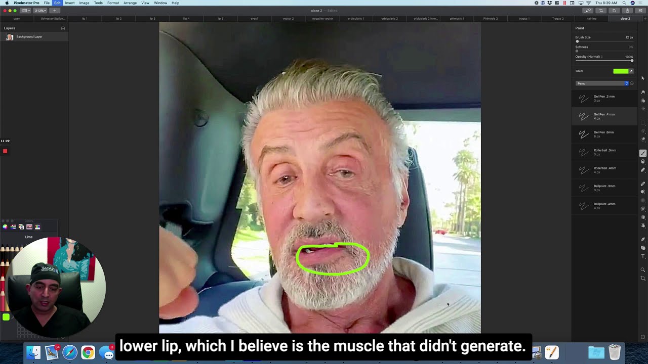 Man discussing lower lip muscle issue.