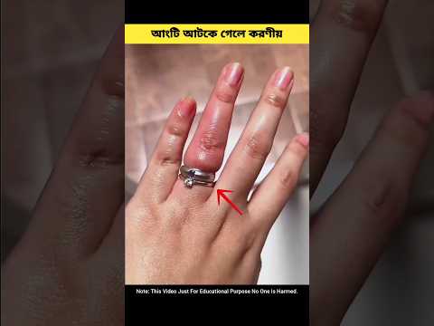 আংটি আটকে গেলে করণীয় ! #shorts #shortvideo #ytshorts