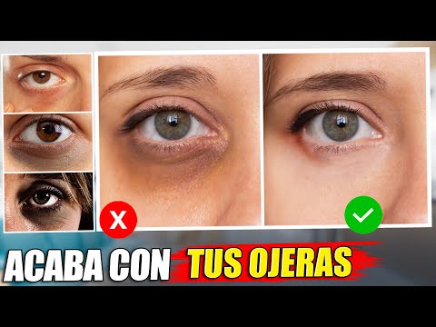 CÓMO "ELIMINAR" LAS OJERAS CORRECTAMENTE!