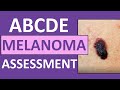 Skin Lesion Assessment and Characteristics