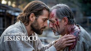 "El Leproso Olvidado: El Hombre Que Jesús Tocó"
