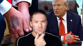 Is Donald Trump Dying?