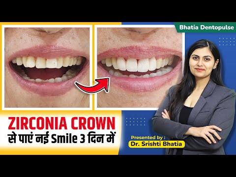 Zirconia Crowns से पाएं नयी Smile 3 दिन में I Dr. Srishti Bhatia #smile #smilemakeover #beautiful