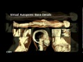 Advancements in Medical Imaging Technology