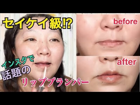 まるでセイケイ級⁉︎痛くないリッププランパー