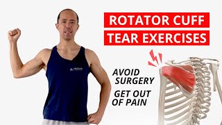 3 Keys to Rehab a Rotator Cuff Tear & AVOID Surgery [NEW EXERCISES]