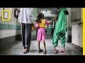 Understanding Clubfoot and Its Treatment