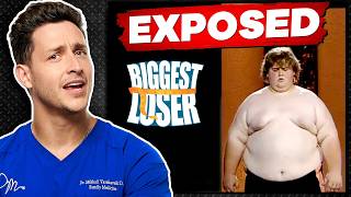 Doctor Reacts To The Biggest Loser Controversy