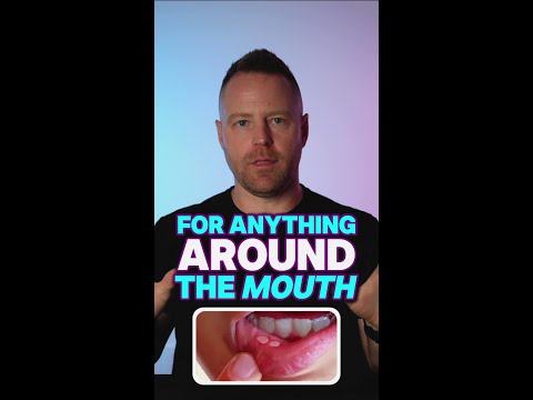 If you have mouth sores try this...