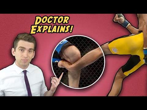 The Untold Side of the Most Famous Injury In UFC History - Anderson Silva's Broken Leg